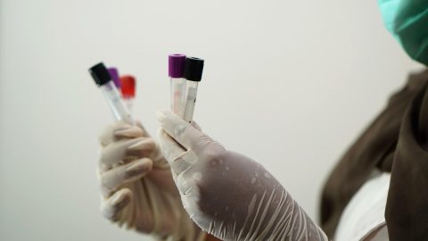 研究人员在实验室分析人兽共患病病原体样本，白色实验服，精密仪器，专业学术环境